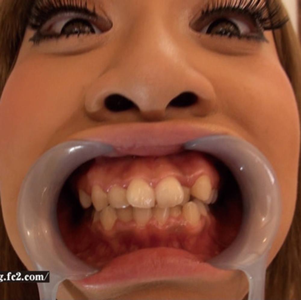 【歯フェチ動画】黒ギャル痴女に開口器をつけてもらい、歯みがき