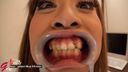 【Tooth fetish video】Have a black gal wear a mouth opening and brush her teeth