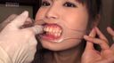 【Dental fetish interview-oral size measurement-observation-mouth aperture】Oral shame! Amateur dental examination Koharu-chan