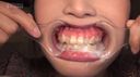 【牙菌斑採集、刷牙、線牙籤、鏡中觀察】口羞！ 業餘牙科檢查小春醬