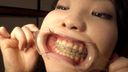 [World pre-release] Amateur dental lewd examination woman in correction / amateur daughter Miki-chan (tentative) digital photo book