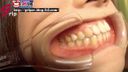 【Tooth fetish oral fetish】Mouth aperture observation of temporary employee Yumi-chan - large mirror observation