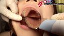 【Tooth fetish oral fetish】Mouth aperture observation of temporary employee Yumi-chan - large mirror observation