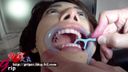 【Tooth Fetish Oral Fetish】I did dental *** of the oral cavity of the mirror ran
