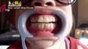 JD Rin-chan's spit licking feet & mouth opening device viewing masturbation