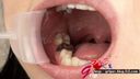 【Oral fetish tooth fetish】We observed Mirai Himeno's teeth