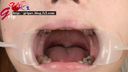 つるのゆうの口腔内を接写して銀歯や喉ちんこを観察しました