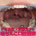 舌ピアスドＳ痴女・天野カナの口腔内の銀歯・喉ちんこを観察しました