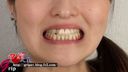 舌ピアスドＳ痴女・天野カナの歯みがきとうがいを接写で観察しました