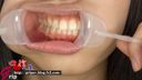 【Oral fetish】Moe Kurashina's oral throat observation & gum tickling