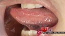 【Oral fetish】Moe Kurashina's oral throat observation & gum tickling