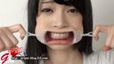 I put on a mouth opening and went sightseeing with Yuria Seto's tooth decay & silver teeth that exposed the inside of the mouth.
