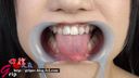 開口器を装着した吉村杏菜ちゃんの口腔内、銀歯や喉ちんこを接写観察