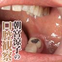 美熟女・朝宮涼子の熟れた口腔内（歯・喉ちんこ）を接写観察しました