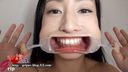 【Oral fetish】Observe violet teeth, throat dicks, and wisdom teeth with mouth openings