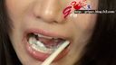 【口腔フェチ】女子校生・希美ゆうの口腔内鑑賞（銀歯４本）歯みがき