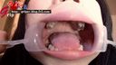 【戀口】女學生優希的欣賞（4顆銀牙）刷牙