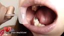 【口腔フェチ】開口器をつけた甲斐ミハルの歯・歯茎・粘膜を接写鑑賞