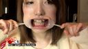 Ryoko during orthodontics masturbates with a mouth opener and saliva dripping and gums bare