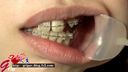 【Oral fetish】Super close-up observation of amateur Ryoko's teeth and oral cavity during orthodontics