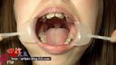 【口腔フェチ】歯列矯正中の素人リョウコの歯・口腔内を超接写観察