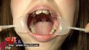 【Oral fetish】Super close-up observation of amateur Ryoko's teeth and oral cavity during orthodontics