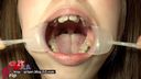 【Oral fetish】Super close-up observation of amateur Ryoko's teeth and oral cavity during orthodontics