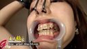 Lyoko during orthodontics is made into a nose hook & mouth opening ** and rape