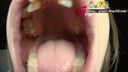 A waterproof camera sneaks into Ryoko's oral cavity during orthodontics and licks a real lens