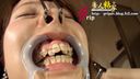 Tickling Ryoko during braces with nose hook & mouth opening restraint**