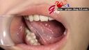 【口腔フェチ】開口器つけた菖蒲るいの歯・喉ちんこ・口腔粘膜を接写