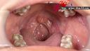 【Oral fetish】Close-up of irises teeth, throat dick, oral mucosa with mouth opening