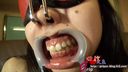 Urea Sakuraba with a nose hook and mouth opening climaxes with blindfolded electric masturbation