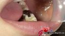 【구강 페티쉬】나츠키의 은색 이빨 잇파이 구강을 입 구멍으로 클로즈업 감상