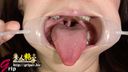 Oral appreciation of Megumi, an amateur girl, wearing a mouth aperture (1 out of 2 silver teeth)