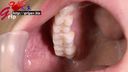 63毫米長舌頭柯高利安戴著嘴巴張開，欣賞兩顆銀牙口腔和刷牙