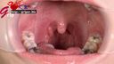 63 mm long tongue Kodaka Riyasu wears a mouth opening and appreciates two silver teeth oral and brushes teeth