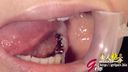 【戀牙癖】女大學生加奈美張嘴的5顆銀牙