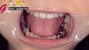 【戀牙癖】女大學生加奈美張嘴的5顆銀牙