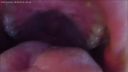[Fetish: Super close-up video of mouth, lips, tongue, saliva, velo, brim] What is a with a camera?