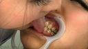Whitening 4 ~ Sterilize gal's gums with saliva ~