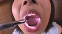 ★★ Amateur Tooth Fetishcute ★★★ Cute Saki-chan ★ Observed ★ with Teeth & Opening Appliance