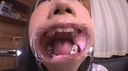 Rinka-chan ★★ amateur tooth fetish ★★★ full of silver teeth and inlays