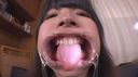 ★★★ Amateur fetish Cute Moemi-chan Observation using teeth & mouth opening device ☆ Close-up ★ ★ realism ☆ Tooth fetish very excited ★★