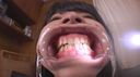 ★★★ Amateur fetish Cute Moemi-chan Observation using teeth & mouth opening device ☆ Close-up ★ ★ realism ☆ Tooth fetish very excited ★★