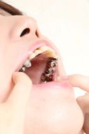 Saki-chan's magnificent silver teeth 45 image data