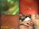 Acme video of female body observation "mouth, vagina, anus" 2