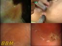 Acme video of female body observation "mouth, vagina, anus" 2