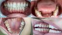 【치아 페티쉬】시이나 리리코 (타치바나 카논)의 아름다운 자연 치아를 관찰