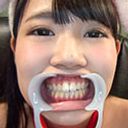 【歯フェチ】ひなたりこちゃんの健康な天然歯観察！